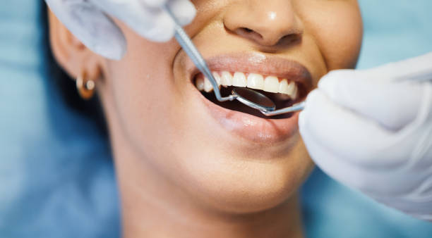 Best Emergency Treatment for Dental Infections or Abscesses in Vine Hill, CA