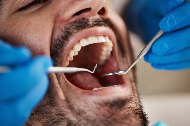Best Emergency Gum Treatment in Vine Hill, CA